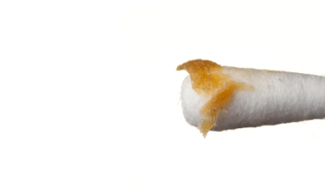 AI Sniffs Out Parkinson’s with 94% Accuracy – Using Earwax