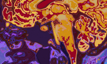 World’s Biggest Body Scan Study Reaches 100,000 Milestone